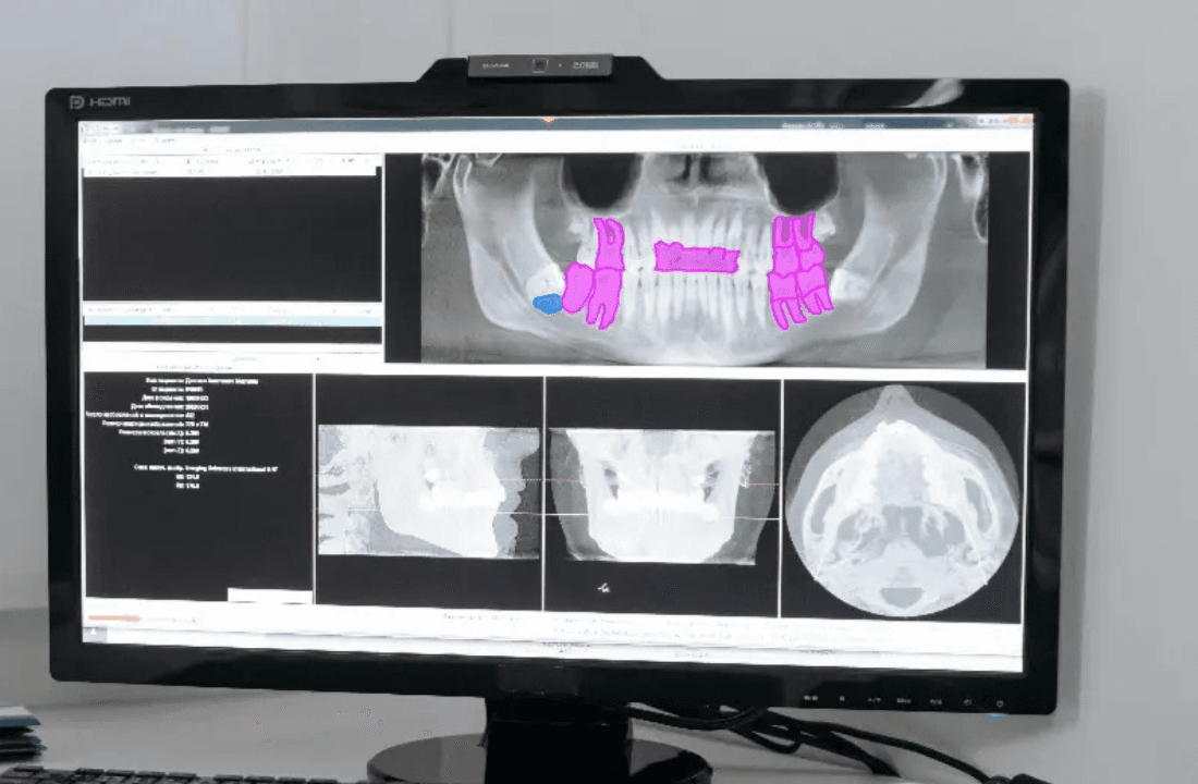 Transforming Healthcare with Predictive Models