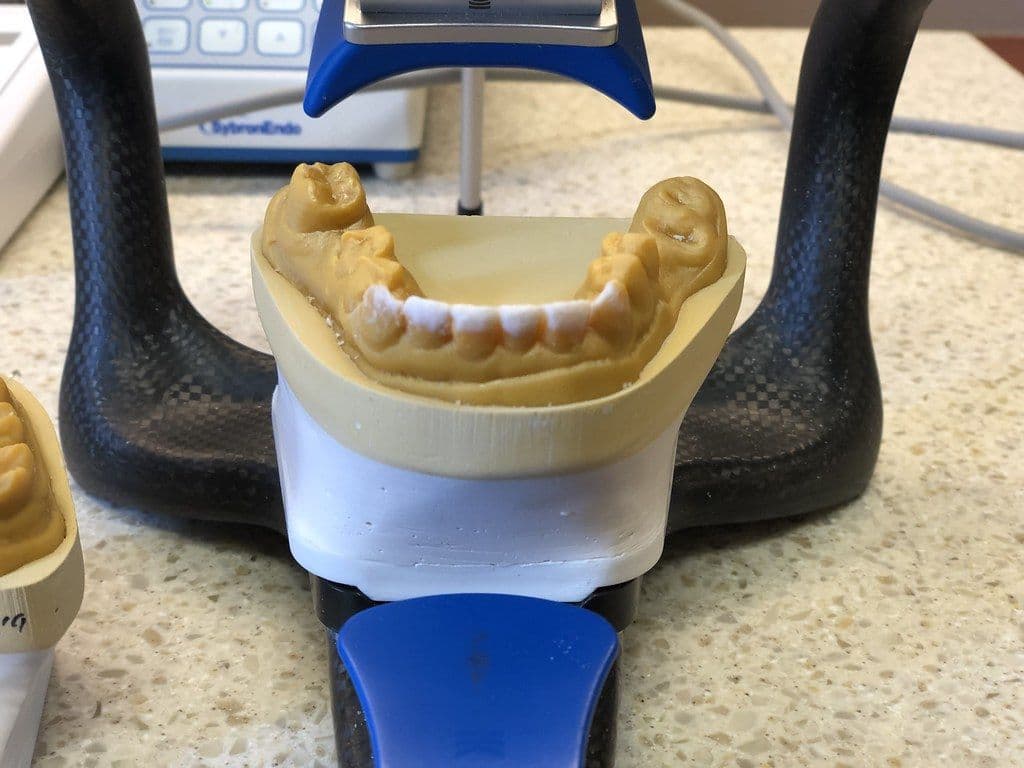 Dental impression model on a lab stand