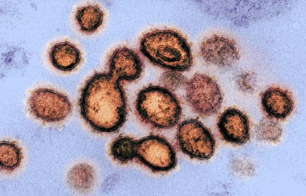 Electron microscope image of virus particles