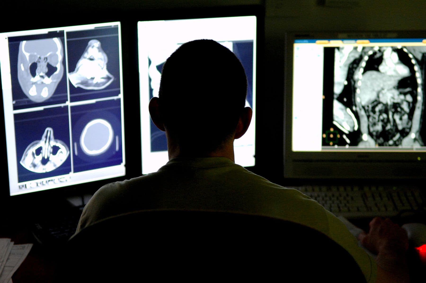 Radiologist reviewing CT scans on monitors