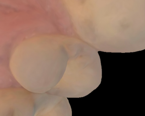 first image