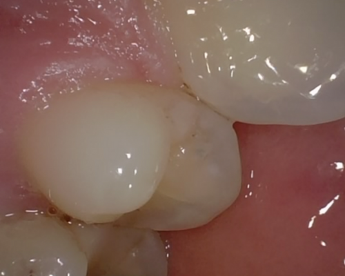 second image