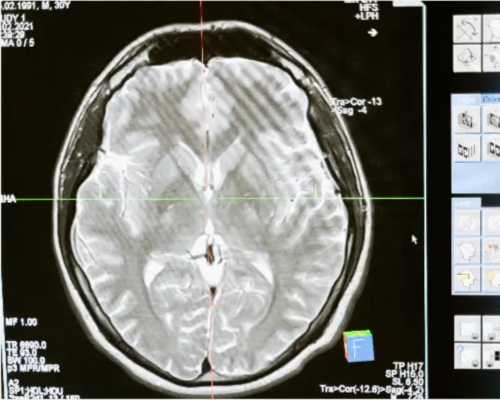 second image